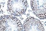 METTL3 Antibody in Immunohistochemistry (Paraffin) (IHC (P))