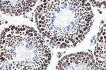 METTL3 Antibody in Immunohistochemistry (Paraffin) (IHC (P))