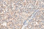 JAK3 Antibody in Immunohistochemistry (Paraffin) (IHC (P))