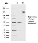 PD-L2/PDCD1LG2/CD273 Antibody in SDS-PAGE (SDS-PAGE)