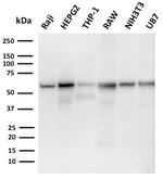 PD-L2/PDCD1LG2/CD273 Antibody in Western Blot (WB)