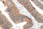 Beta Catenin Antibody in Immunohistochemistry (Paraffin) (IHC (P))