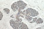 Beta Catenin Antibody in Immunohistochemistry (Paraffin) (IHC (P))