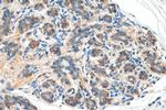 Beta Catenin Antibody in Immunohistochemistry (Paraffin) (IHC (P))