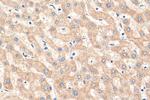 iNOS Antibody in Immunohistochemistry (Paraffin) (IHC (P))