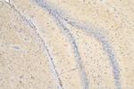 iNOS Antibody in Immunohistochemistry (Paraffin) (IHC (P))