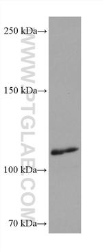 iNOS Antibody in Western Blot (WB)