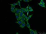 NRF2, NFE2L2 Antibody in Immunocytochemistry (ICC/IF)