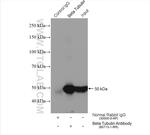 Beta Tubulin Antibody in Immunoprecipitation (IP)