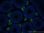 STAR Antibody in Immunohistochemistry (Paraffin) (IHC (P))