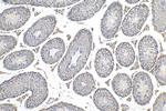 STAR Antibody in Immunohistochemistry (Paraffin) (IHC (P))