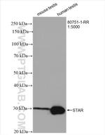 STAR Antibody in Western Blot (WB)