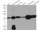 STAR Antibody in Western Blot (WB)