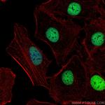 PAX8 Antibody in Immunocytochemistry (ICC/IF)