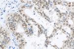 PAX8 Antibody in Immunohistochemistry (Paraffin) (IHC (P))