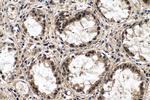 METTL14 Antibody in Immunohistochemistry (Paraffin) (IHC (P))