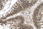 METTL14 Antibody in Immunohistochemistry (Paraffin) (IHC (P))