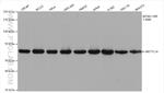 METTL14 Antibody in Western Blot (WB)