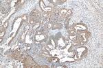 AKT1 Antibody in Immunohistochemistry (Paraffin) (IHC (P))