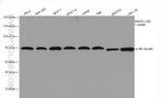 NF-kappa B p65 Antibody in Western Blot (WB)