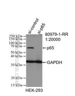 NF-kappa B p65 Antibody in Western Blot (WB)