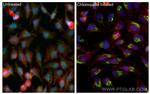 LC3 Antibody in Immunocytochemistry (ICC/IF)