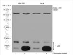 LC3 Antibody in Western Blot (WB)