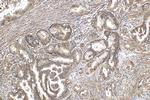 S100A10 Antibody in Immunohistochemistry (Paraffin) (IHC (P))