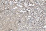 S100A10 Antibody in Immunohistochemistry (Paraffin) (IHC (P))