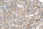 S100A10 Antibody in Immunohistochemistry (Paraffin) (IHC (P))