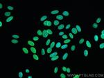 Lamin A/C Antibody in Immunocytochemistry (ICC/IF)