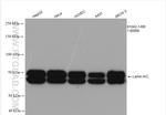 Lamin A/C Antibody in Western Blot (WB)