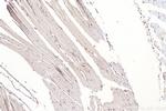 YAP1 Antibody in Immunohistochemistry (Paraffin) (IHC (P))