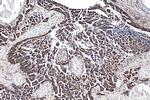 YAP1 Antibody in Immunohistochemistry (Paraffin) (IHC (P))