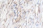 YAP1 Antibody in Immunohistochemistry (Paraffin) (IHC (P))