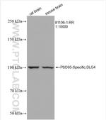 PSD95 Antibody in Western Blot (WB)