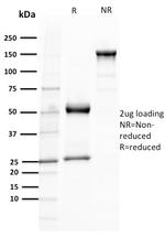 TCL1 Antibody in SDS-PAGE (SDS-PAGE)