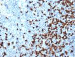 TCL1 Antibody in Immunohistochemistry (Paraffin) (IHC (P))