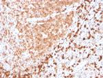 TCL1 Antibody in Immunohistochemistry (Paraffin) (IHC (P))