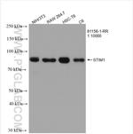 STIM1 Antibody in Western Blot (WB)