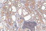 HDAC3 Antibody in Immunohistochemistry (Paraffin) (IHC (P))