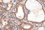 HDAC3 Antibody in Immunohistochemistry (Paraffin) (IHC (P))