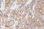 HDAC3 Antibody in Immunohistochemistry (Paraffin) (IHC (P))