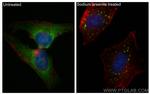 YTHDF2 Antibody in Immunocytochemistry (ICC/IF)