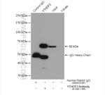 YTHDF2 Antibody in Immunoprecipitation (IP)