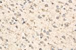 EEF1A1 Antibody in Immunohistochemistry (Paraffin) (IHC (P))