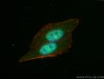 FTO Antibody in Immunocytochemistry (ICC/IF)