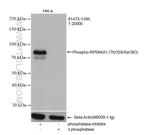 Phospho-RPS6KA1 (Thr359, Ser363) Antibody in Western Blot (WB)