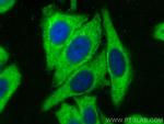 ENO1 Antibody in Immunocytochemistry (ICC/IF)