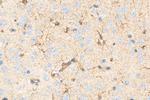 ENO1 Antibody in Immunohistochemistry (Paraffin) (IHC (P))